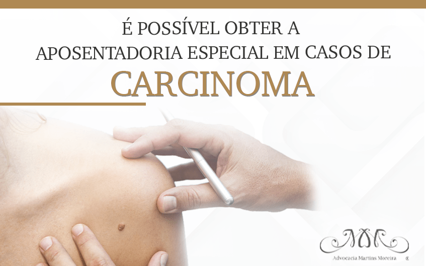 Aposentadoria para quem tem carcinoma